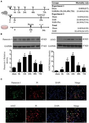 Probenecid-Blocked Pannexin-1 Channel Protects Against Early Brain Injury via Inhibiting Neuronal AIM2 Inflammasome Activation After Subarachnoid Hemorrhage